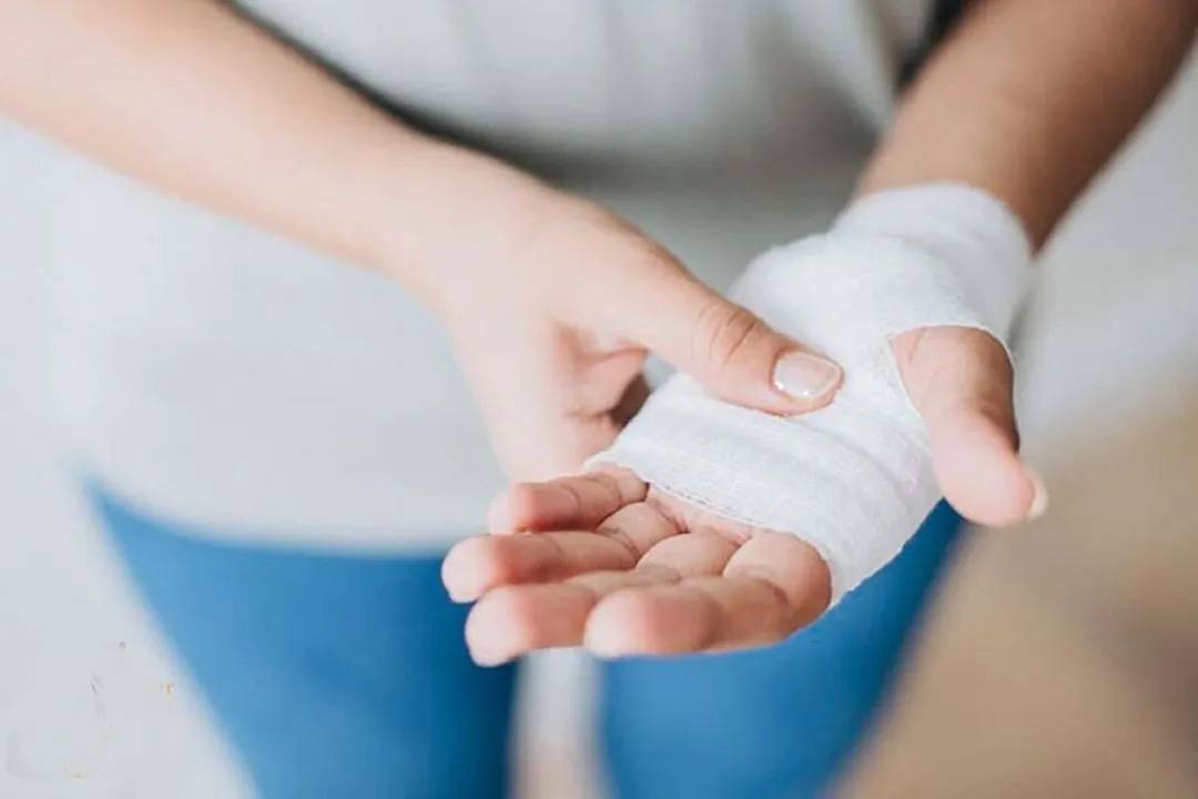 اگر دچار جراحت شدید، زخم را به‌درستی تمیز و پانسمان کنید و از پمادهای ترمیمی استفاده کنید.
